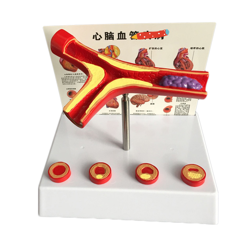 Medical Lab And Science - Forniture da laboratorio per modelli vascolari